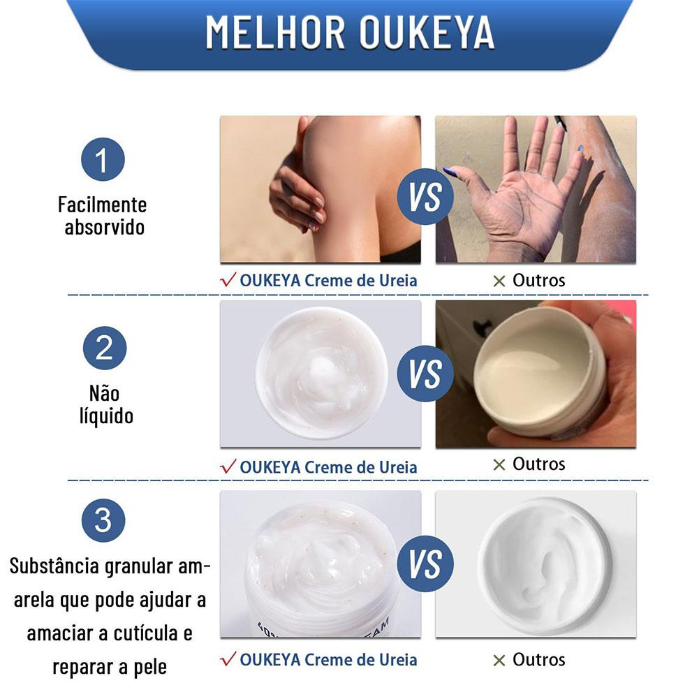 كريم اليوريا 40% مرطب ومضاد لل - مراجعة Urea Foot Cream وسعره